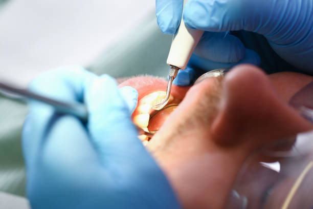 Best Pediatric Emergency Dentist in Marlinton, WV