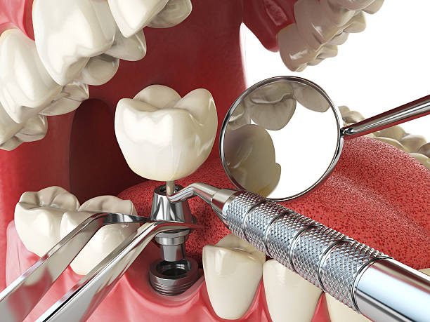 Best Emergency Broken Tooth Repair in Marlinton, WV